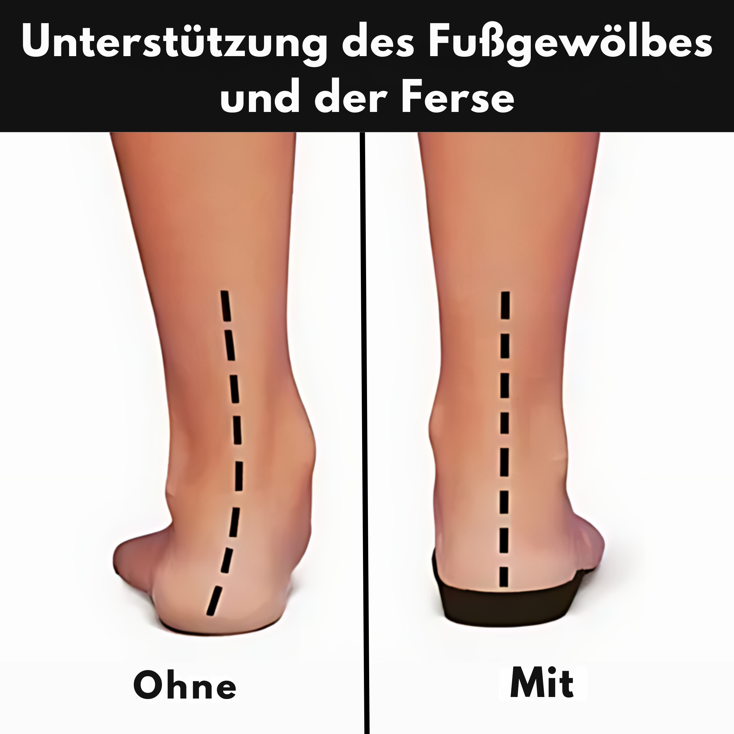 Buty Ortopedyczne Damskie Z Arch Support – Amortyzujące, Wygodne, Idealne Do Codziennego Użytku 8